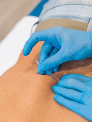 20221011_CentroMotionis_Fisioterapia_253 Zona-lumbar