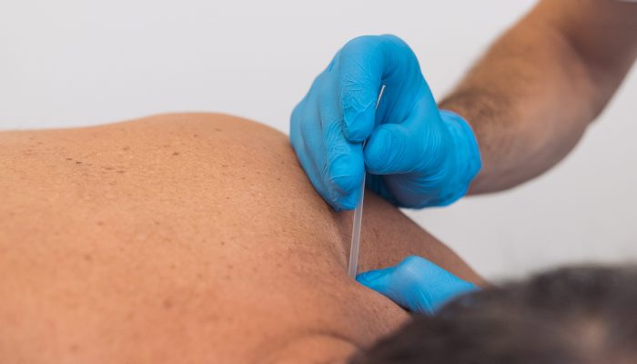 20221011_CentroMotionis_Fisioterapia_251